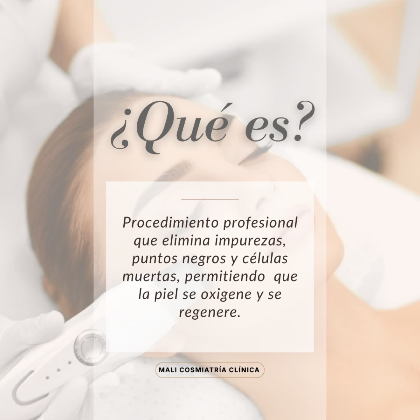Promoción 1